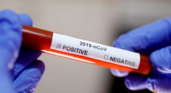 Кто сможет пройти экспресс-тест на COVID-19?