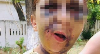 Душили пакетом и выбили зубы. Жестокое нападение на женщину в Шымкенте